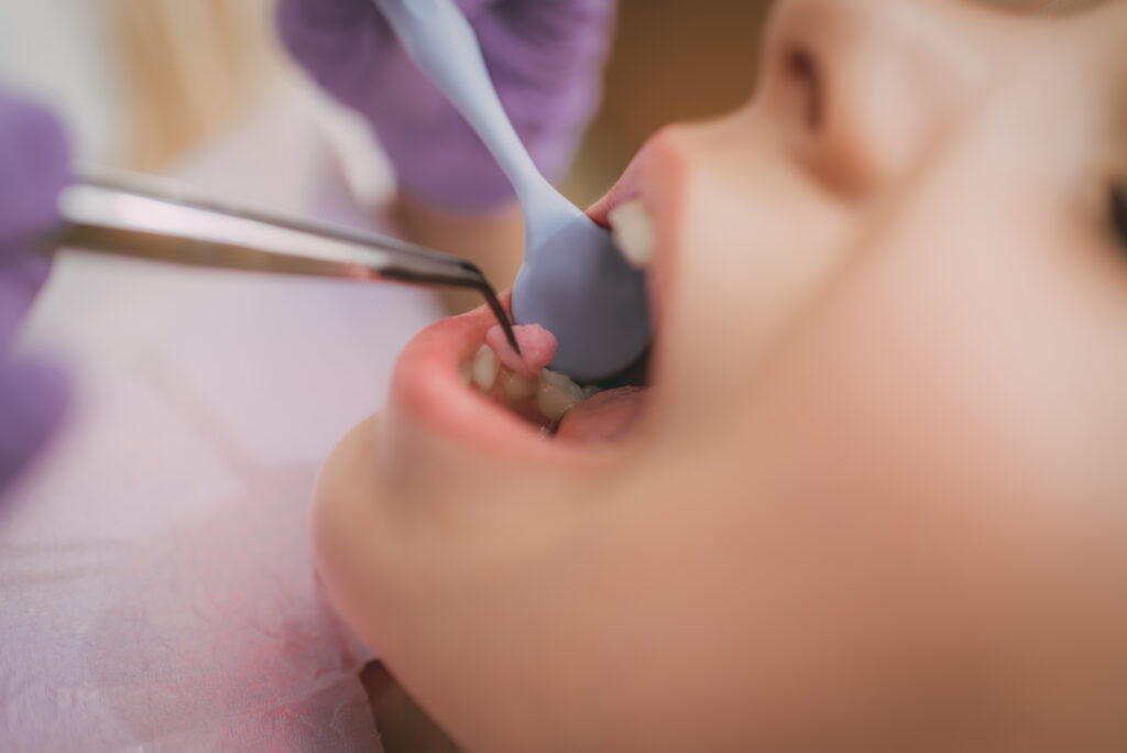Hermosa niña en visita en la oficina del dentista. Dientes de chequeo de dentista en ella. De cerca. Enfoque selectivo.